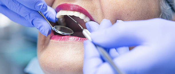 Best Emergency Root Canal Treatment in Neillsville, WI